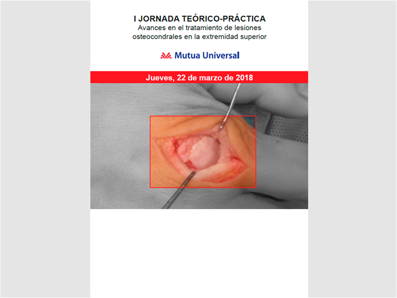 Lesiones osteocondrales en la extremidad superior Lesiones osteocondrales en la extremidad superior
