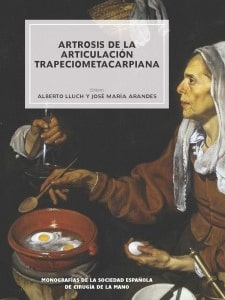 artrosis de la articulacion-min