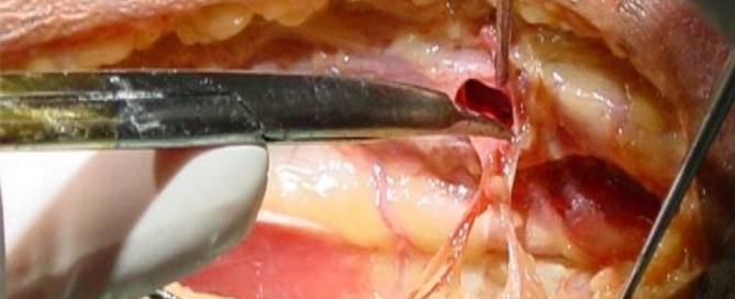anatomia