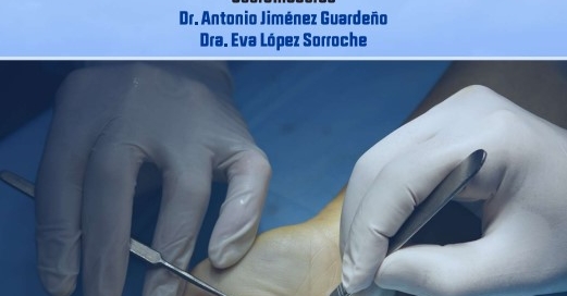 cirugia de la mano