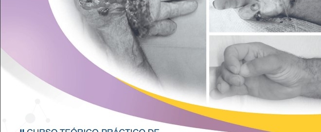 reimplantes