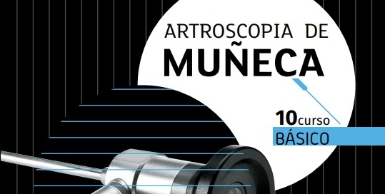 artroscopia munyeca