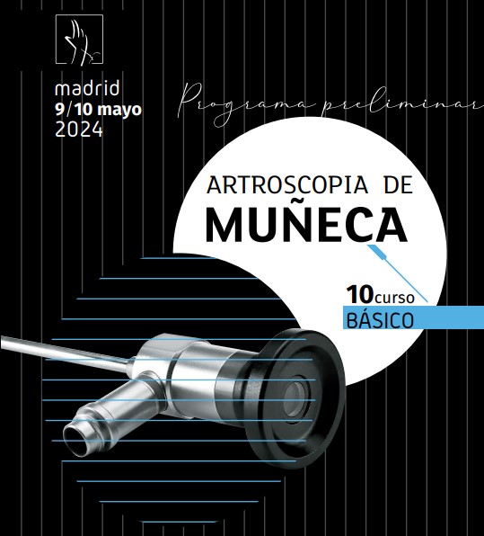 artroscopia munyeca