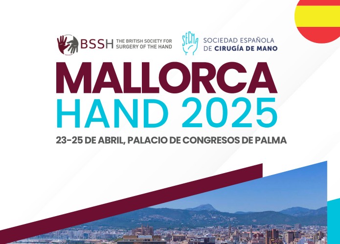 mallorca hand 2025