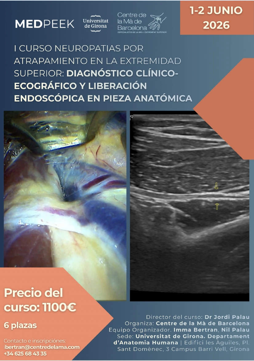 I CURSO NEUROPATIAS POR ATRAPAMIENTO EN LA EXTREMIDAD SUPERIOR: